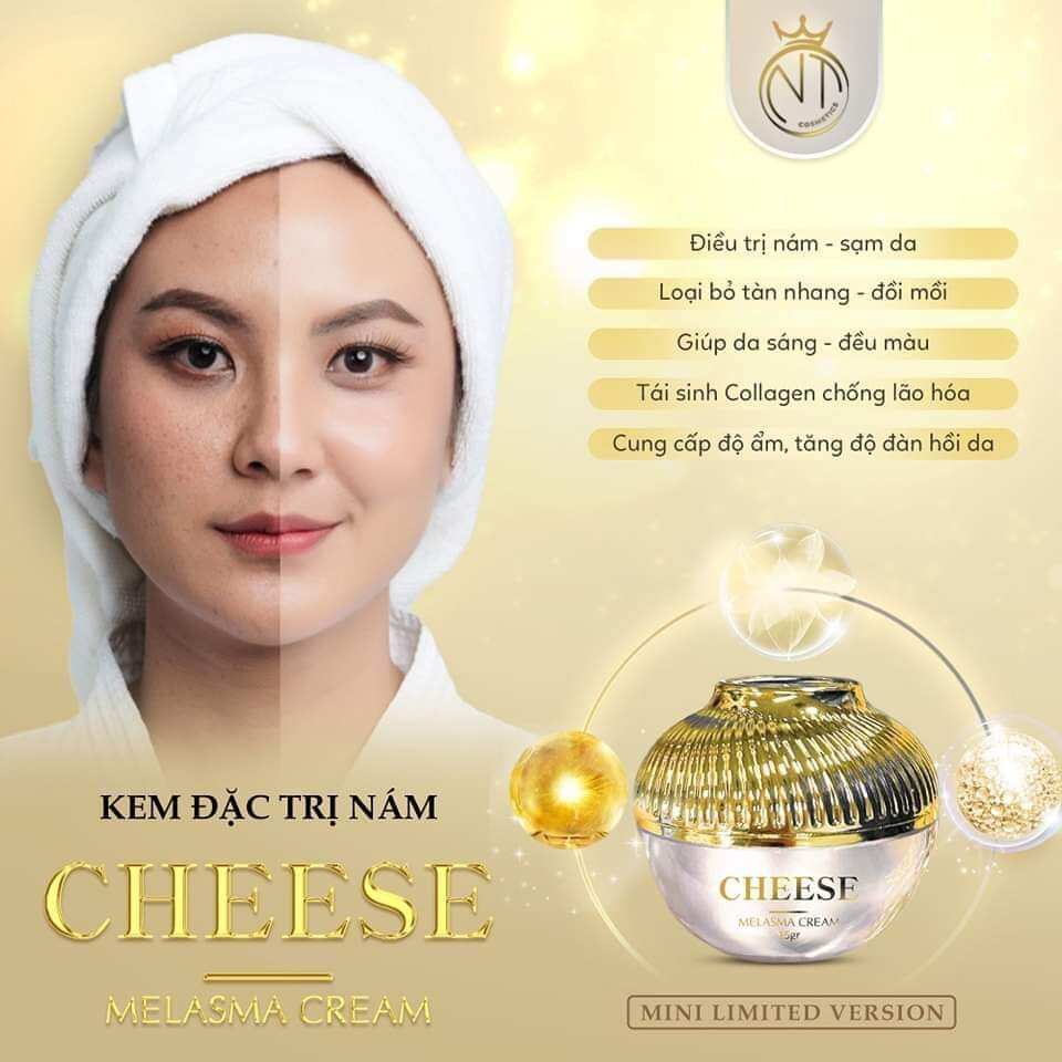 Kem trị nám Melasma Cream