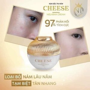 kem trị nám